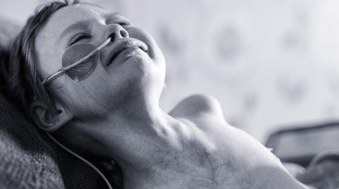 cáncer, niña, dolor, desgarrador