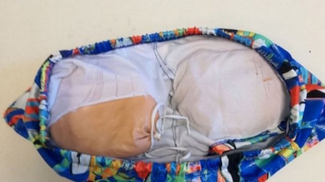 Detienen a "mula" proveniente de Brasil con "falsas nalgas" de cocaína