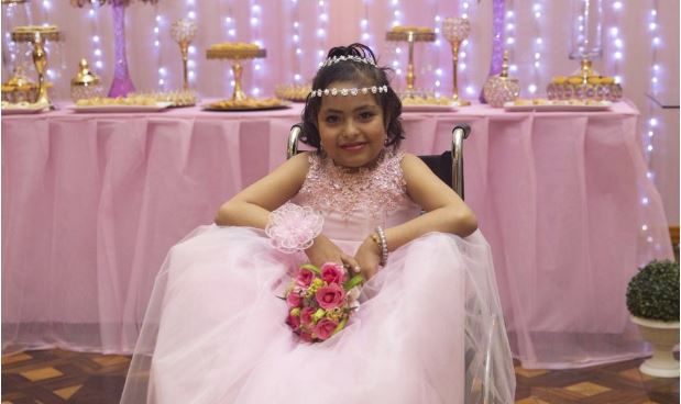 Muere a los 15 años la “niña sirena” de Perú