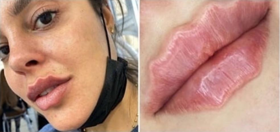 Labios del diablo, la nueva y peligrosa tendencia que está naciendo en Rusia