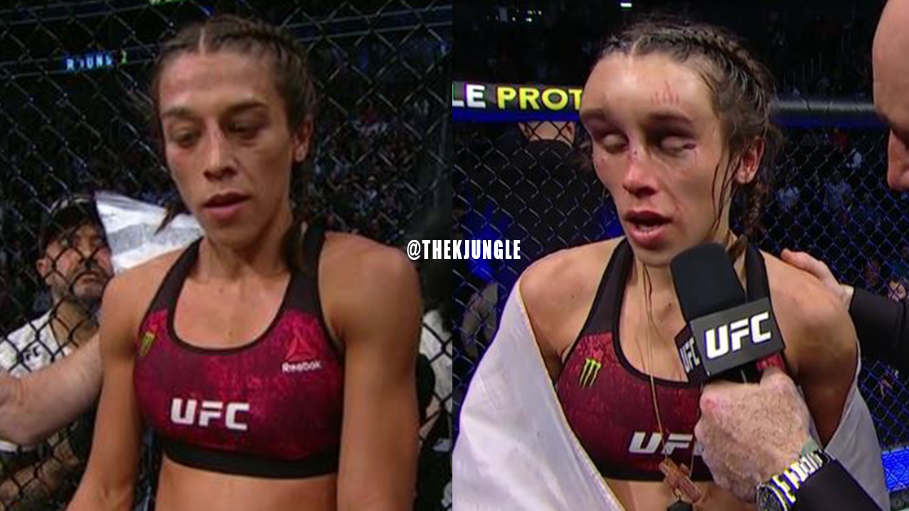 Irreconocible: así quedó el rostro de una luchadora después de arduo combate en la UFC