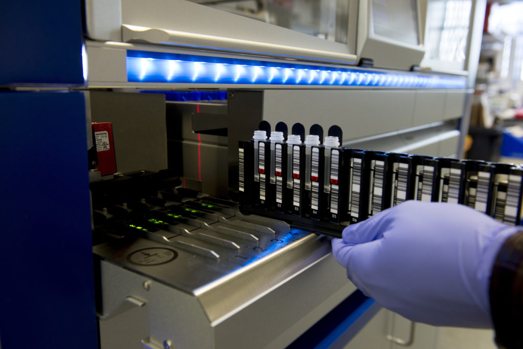 Coronavirus: la universidad de Oxford busca voluntarios para una vacuna basada en un exitoso experimento