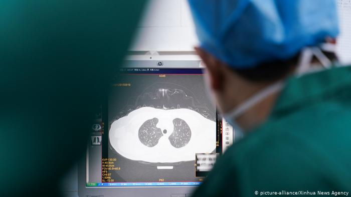 Secuelas del coronavirus: recuperados, pero con pulmones dañados