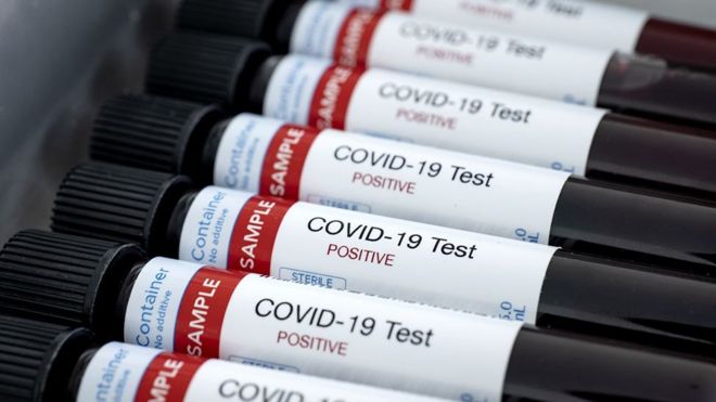La nueva prueba de anticuerpos que es “crucial” para hacer frente a pandemia del coronavirus