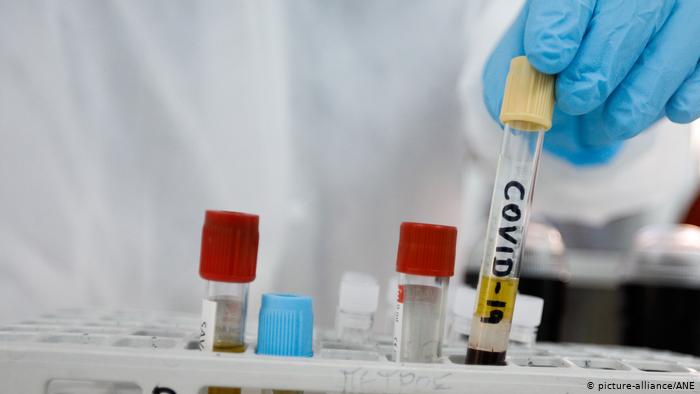Rusia registra un primer fármaco antiviral contra la covid-19