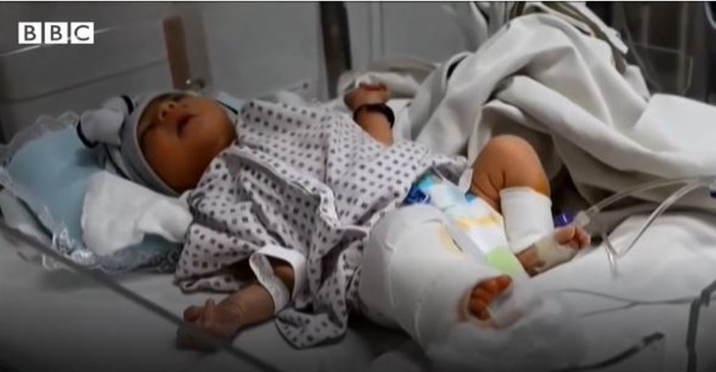 Atentado en Afganistán: la increíble historia de Amina, la bebé recién nacida que sobrevivió a 2 disparos
