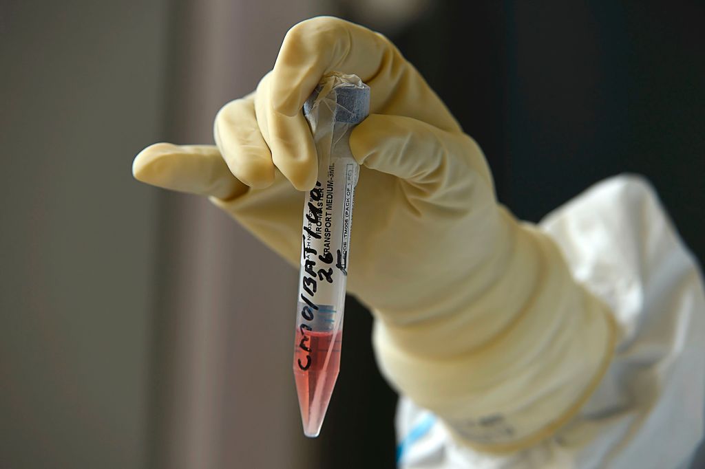 A doctor wearing a protective gear holds a sample test tubes for COVID-19 coronavirus testing during a government-imposed nationwide lockdown as a preventive measure against the COVID-19 coronavirus, in Srinagar on May 9,2020. (Photo by Tauseef MUSTAFA / AFP)