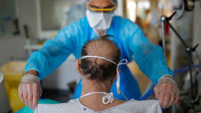 Coronavirus: Médicos advierten de los efectos que el covid-19 puede tener en el cerebro