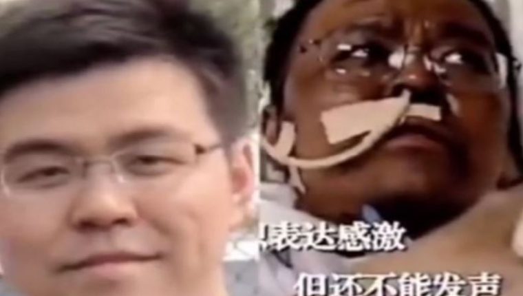 Muere uno de los médicos cuya piel se oscureció tras contraer coronavirus en China