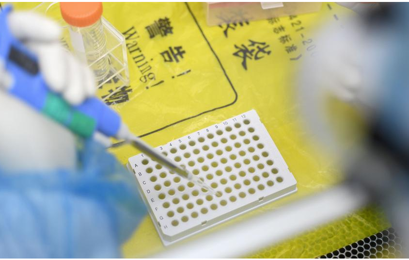 Fármacos usados contra el sida no son eficaces para tratar el coronavirus, revela estudio