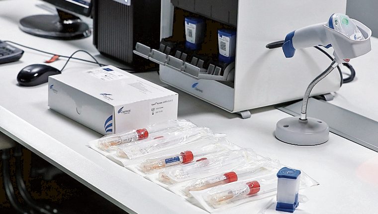 Esta son las razones por las que se demoran los resultados de las pruebas para detectar el covid-19 en Guatemala, según autoridades de Salud
