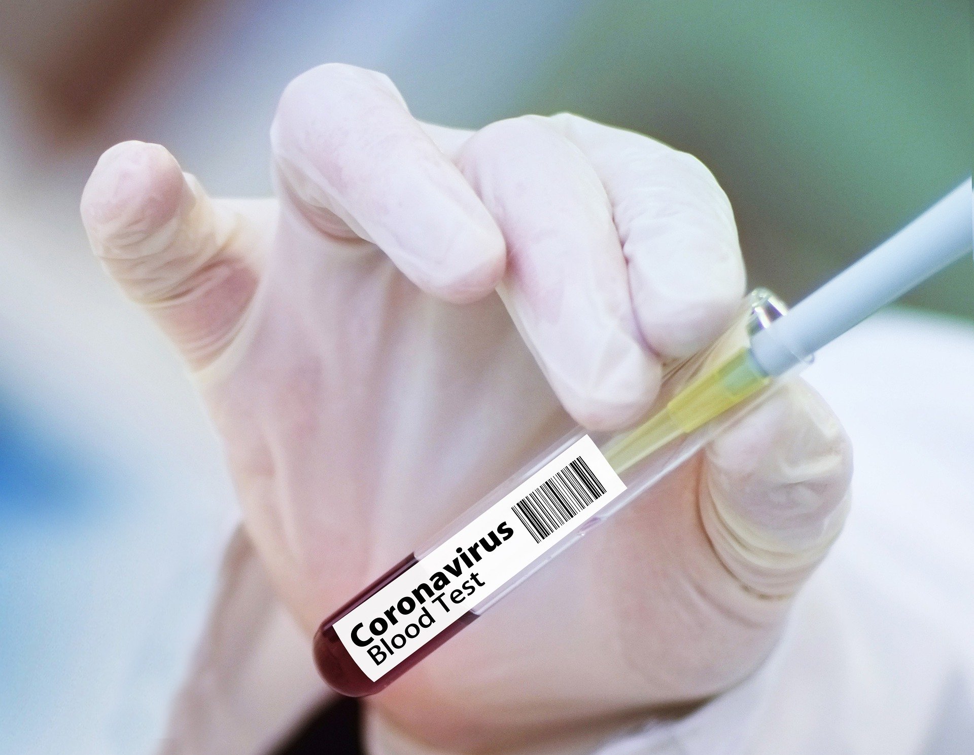 Estados Unidos pagará millonaria suma para adquirir vacunas contra el coronavirus