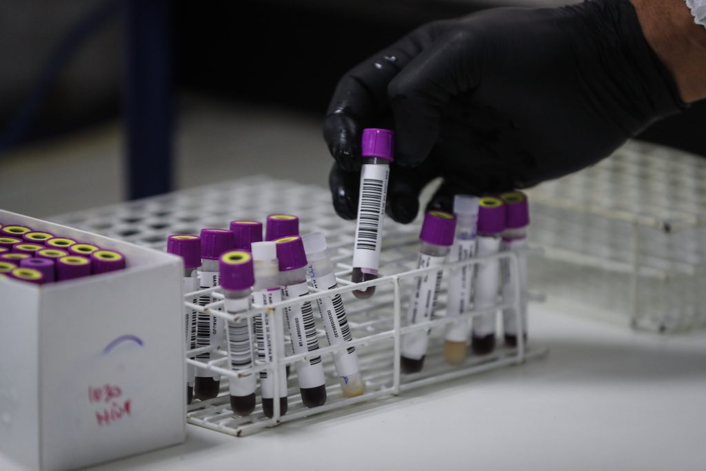 Qué es la quercetina, el compuesto natural que podría convertirse en fármaco para tratar el covid-19