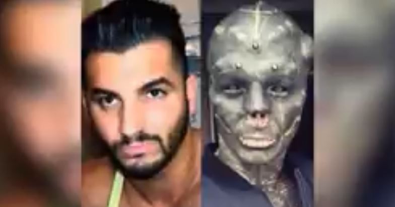 Un hombre se opera para quitarse la nariz, modificarse la lengua y parecer alienígena