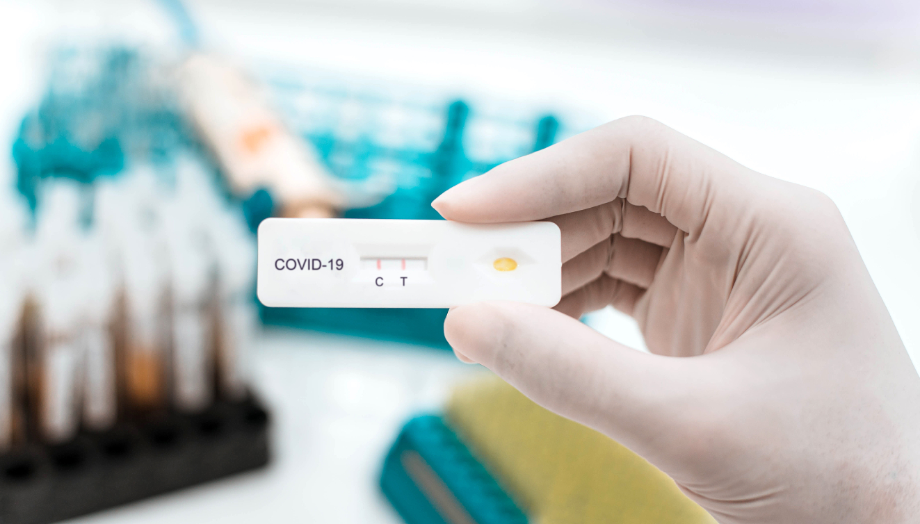 Test rápidos de antígeno para frenar la segunda ola de COVID-19