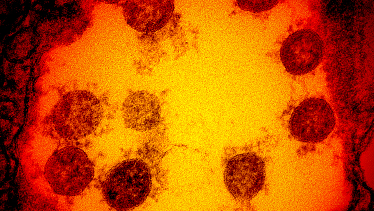 ¿Por qué el coronavirus se propaga ahora con tanta velocidad?