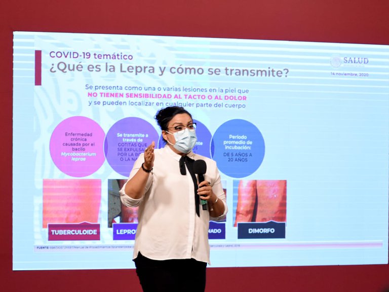 ¿La lepra podría hacer que se te caiga la piel o un brazo?