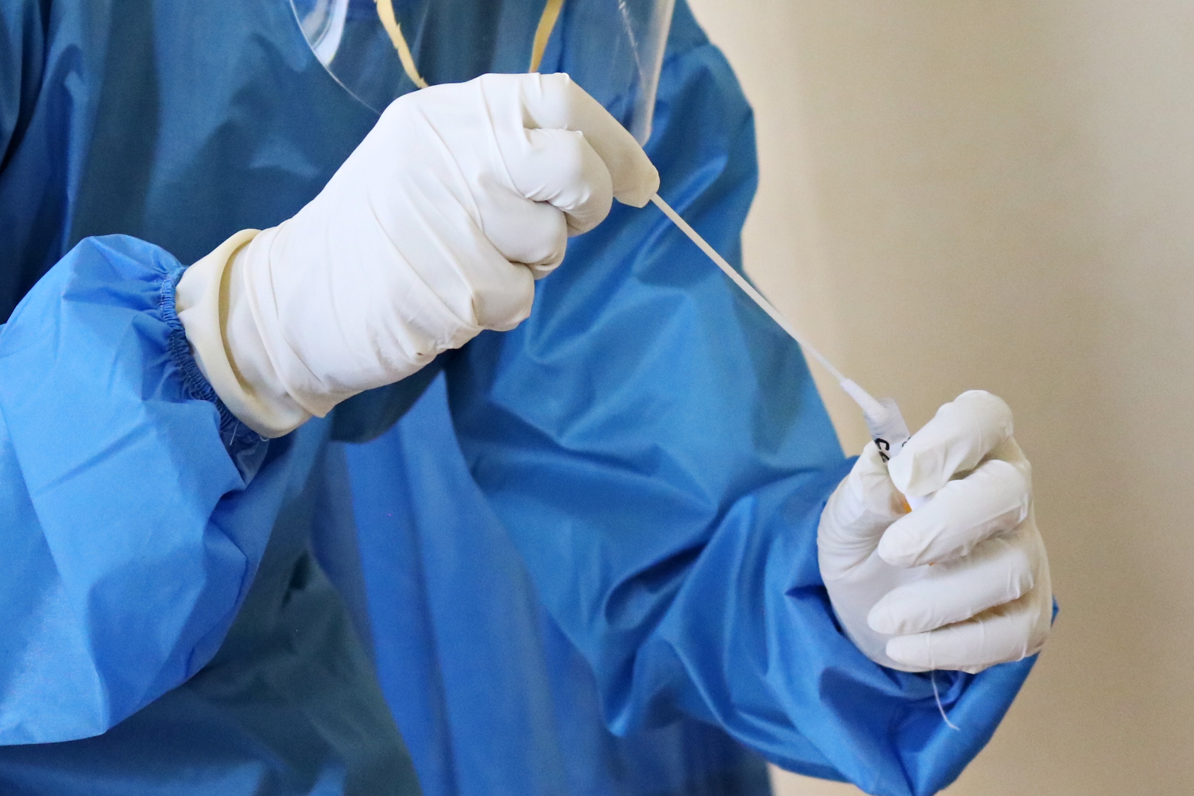 test hisopado coronavirus