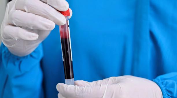 Así es el raro y potencialmente mortal hongo “Candida auris” detectado en Brasil