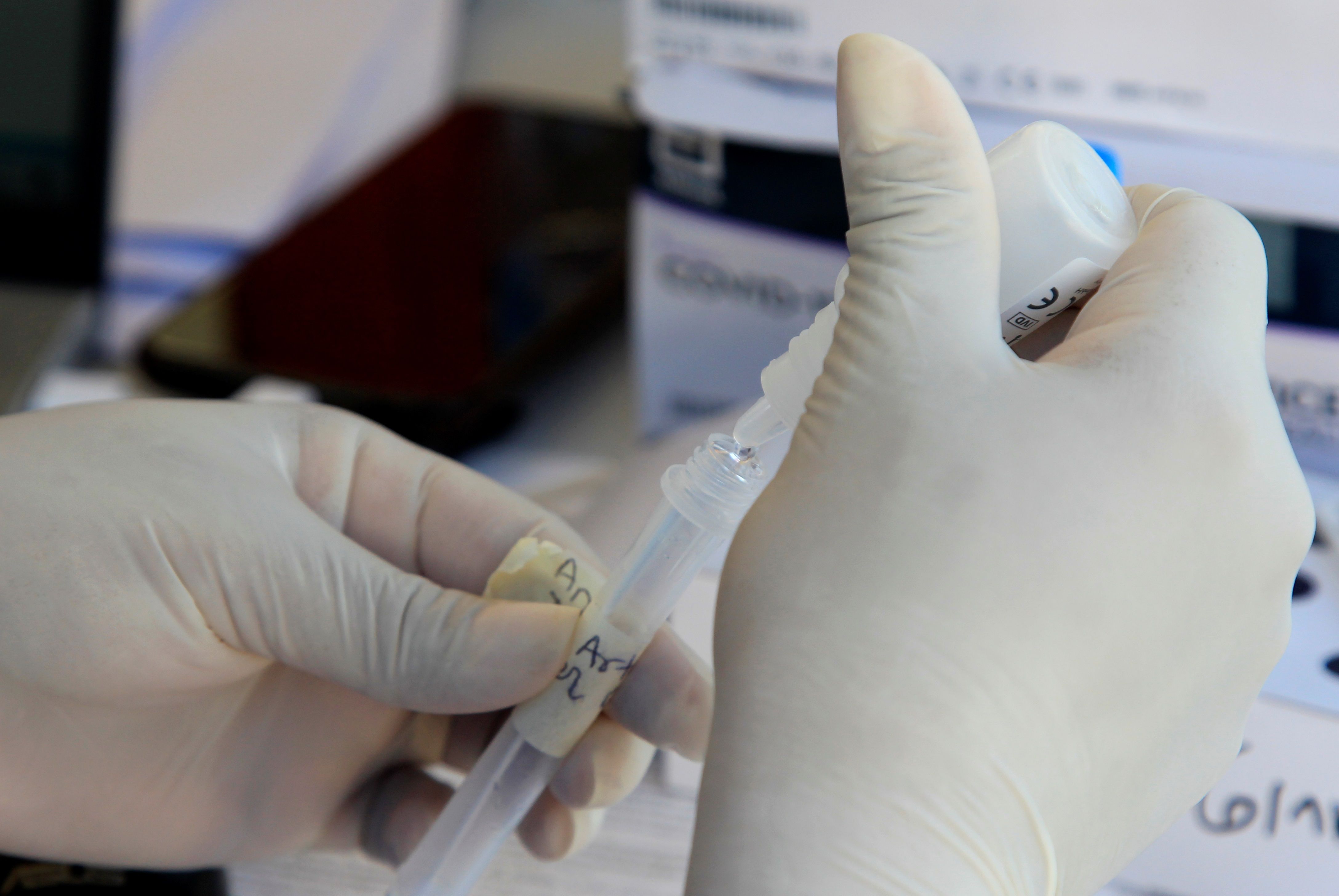 [Viva La Noticia] Efectos psicológicos de la pandemia