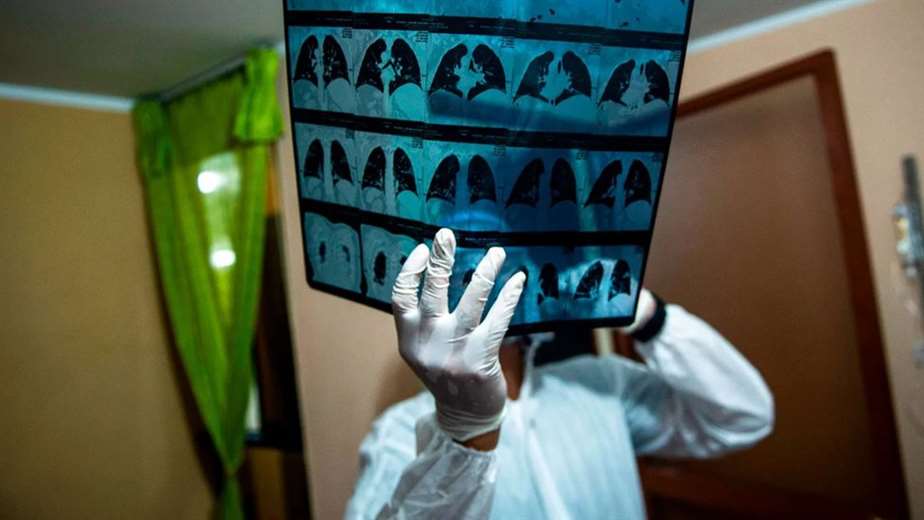 Coronavirus: cómo los pacientes excepcionales exponen los puntos débiles del SARS-CoV-2