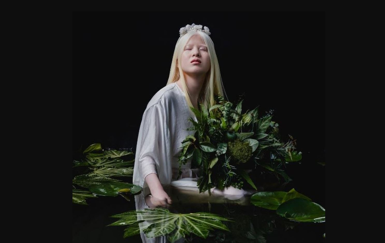 La bebé albina abandonada en China que se convirtió en modelo de Vogue