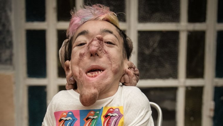 Estás todo lastimado: mi autorretrato como un hombre que vive en un cuerpo ilegal