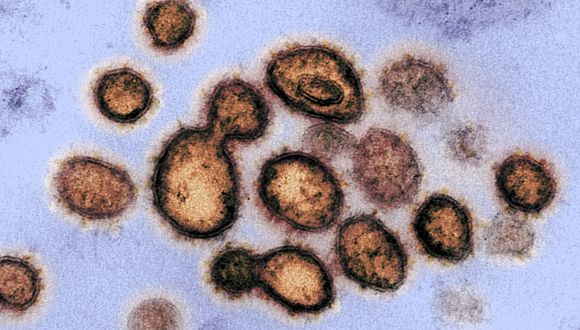 Coronavirus: variante mu pasa a ser “potencialmente preocupante” para la Agencia Europea de Medicamentos