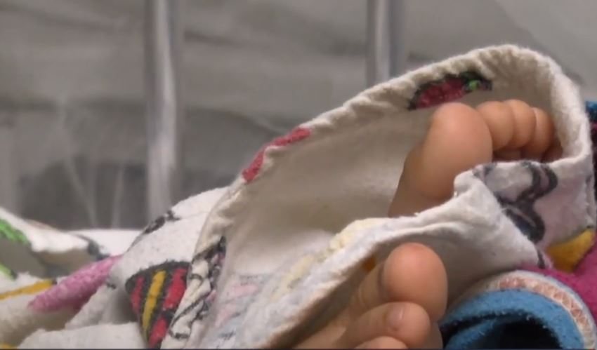 Hospital Roosevelt advierte de que se incrementan las quemaduras en niños y estos son los motivos