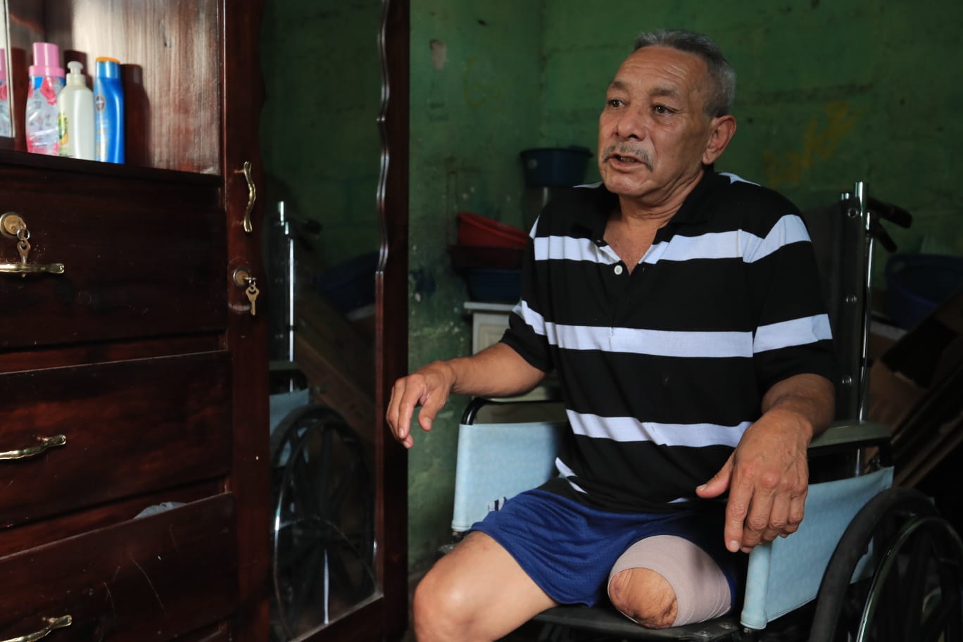 Oscar Osoy vive únicamente con Q25 a la semana para poder comer y necesita una prótesis de pierna