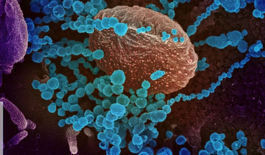 Lo que se sabe de la teoría de un científico que afirma que ómicron pudo mutar de un paciente con VIH