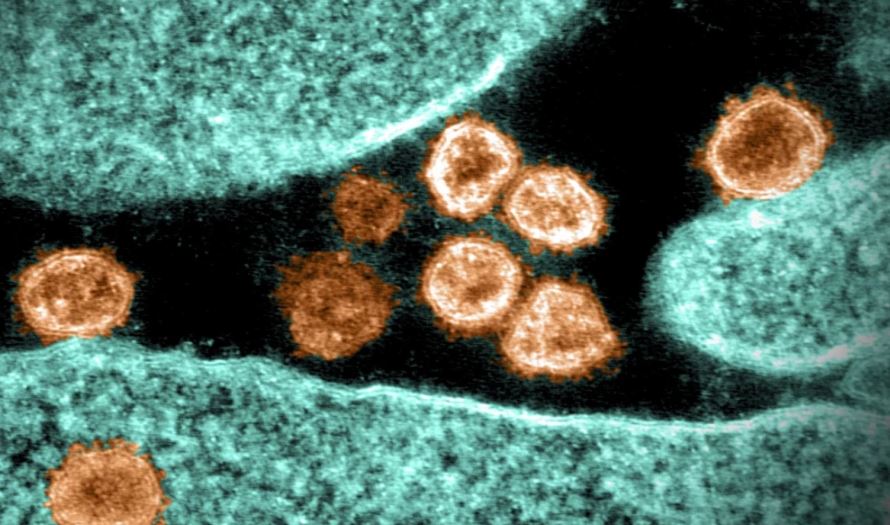 Flurona: detectan en Los Ángeles el primer caso de la extraña infección simultanea entre influenza y covid-19