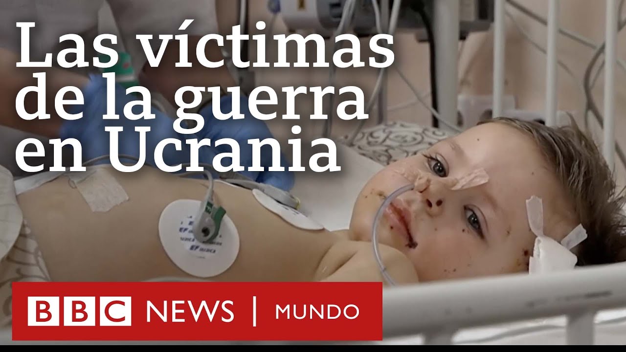 Rusia y Ucrania: el trauma de los niños heridos en los ataques rusos a Mariúpol