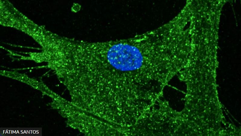 Científicos logran rejuvenecer 30 años las células de la piel de una mujer con la tecnología de la oveja Dolly