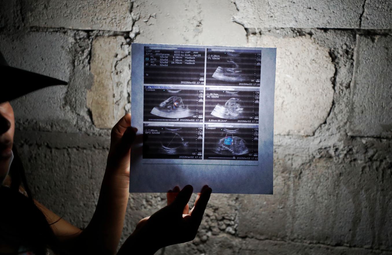 La epidemia normalizada: Embarazos en niñas y jóvenes en Guatemala es una situación escalofriante, afirman expertos
