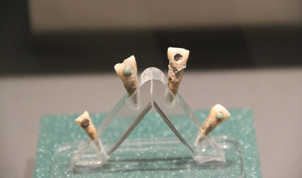Descubren la razón por la que los mayas se incrustaban piedras preciosas en los dientes con un poderoso sellador