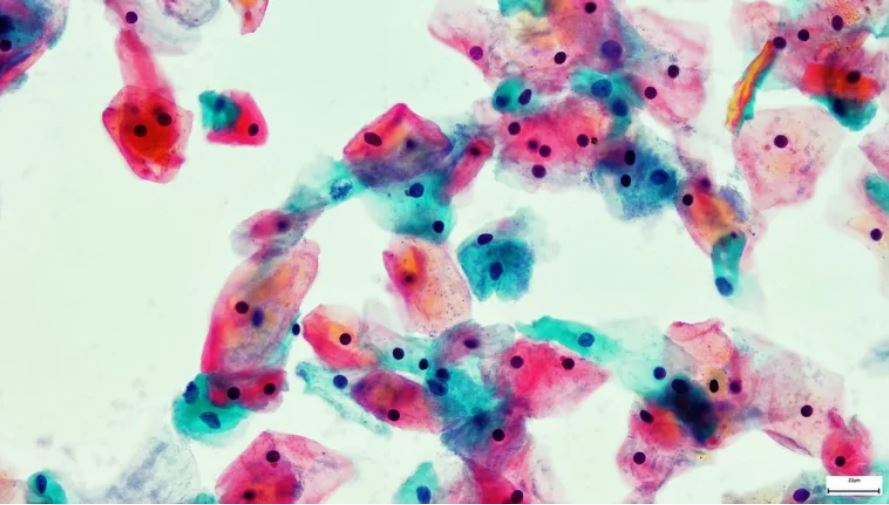 La historia de amor detrás del Papanicolaou, el test que ha salvado millones de vidas de mujeres