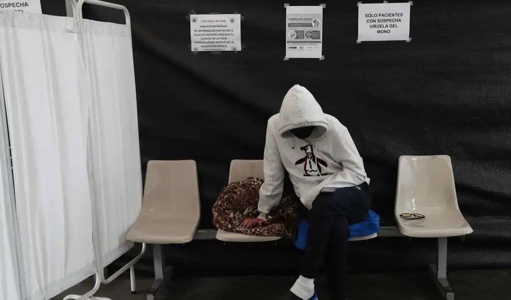A un mes de la detección del primer caso de la viruela del mono, Salud aún no socializa protocolos de prevención