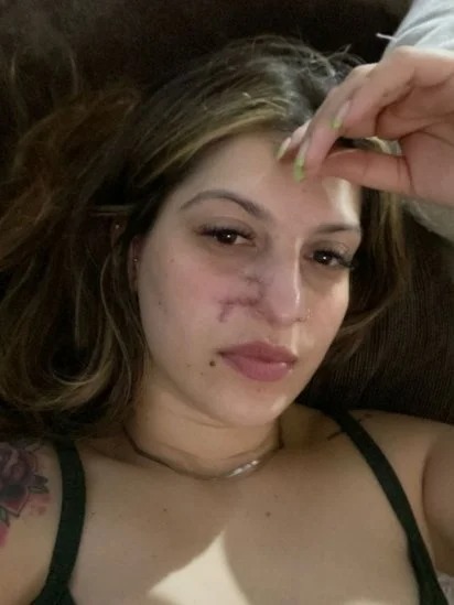 “Una limpieza facial me hizo descubrir que tenía cáncer”