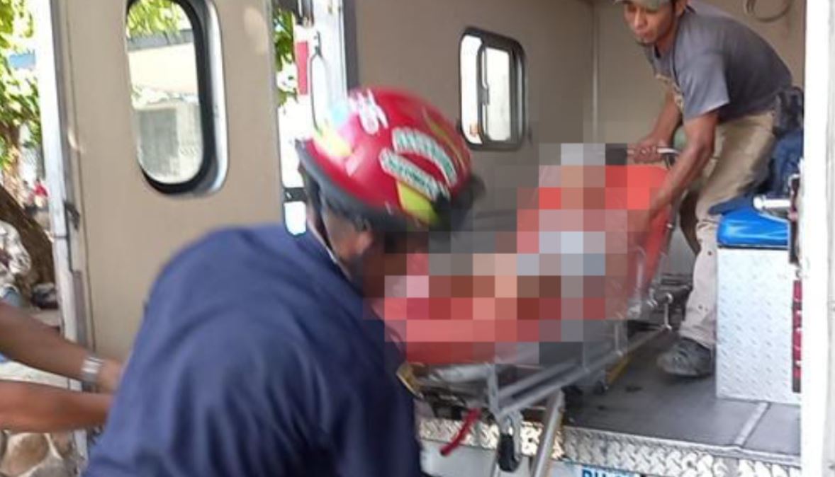 NIÑO ATACADO POR PERROS EN ZACAPA