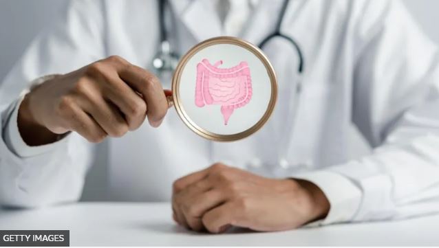 Por qué la enfermedad intestinal inflamatoria es tan difícil de tratar y qué progresos está haciendo la ciencia