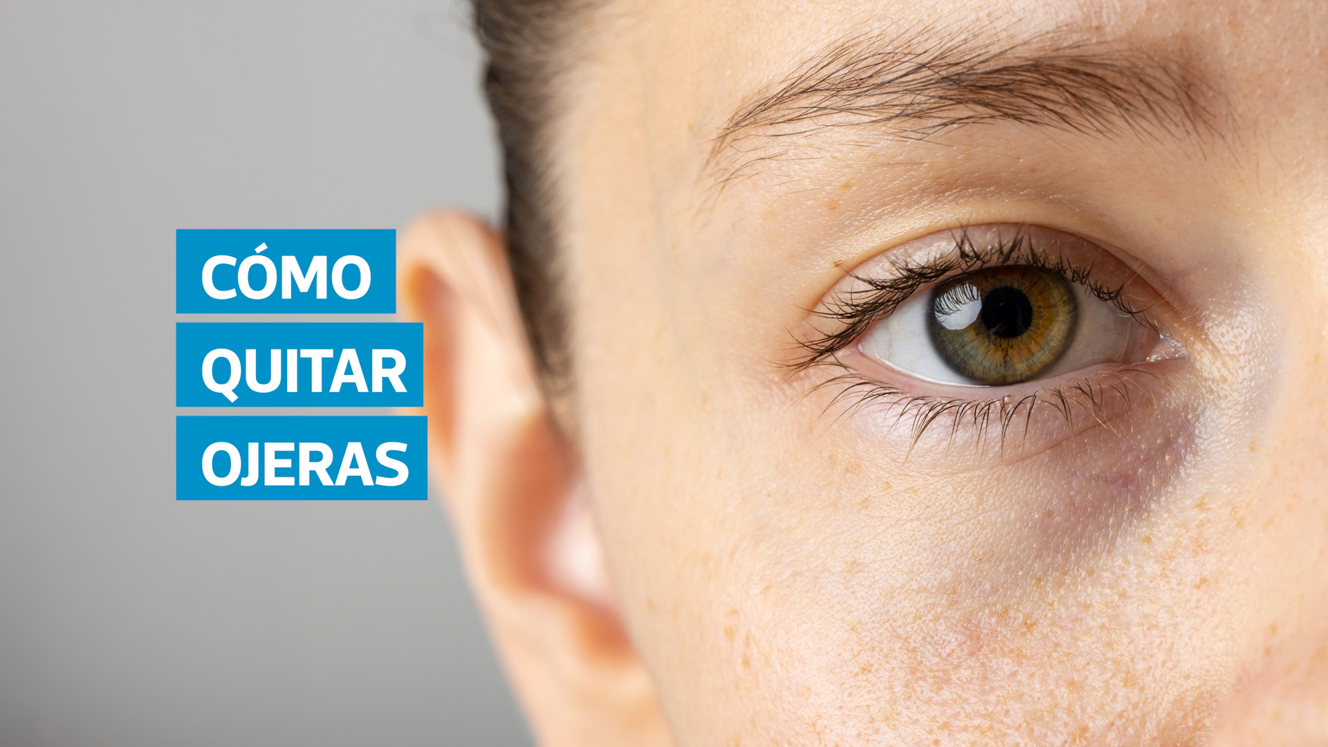Las ojeras no siempre son producto del cansancio. Factores genéticos, alergias, deshidratación o la exposición al sol pueden influir en su aparición. Descubra qué las provoca y las recomendaciones de especialistas para reducirlas y devolverle frescura a su mirada.