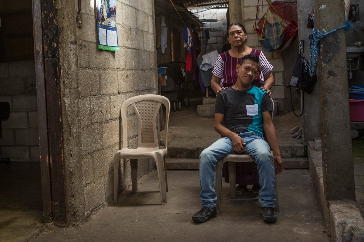 Osiel posa junto a su mamá Susana en su vivienda. (Foto: Napo Sojuel)