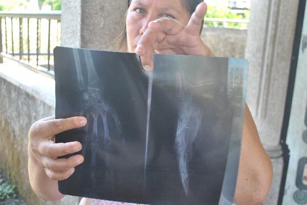 Alicia Mérida muestra  las radiografías.