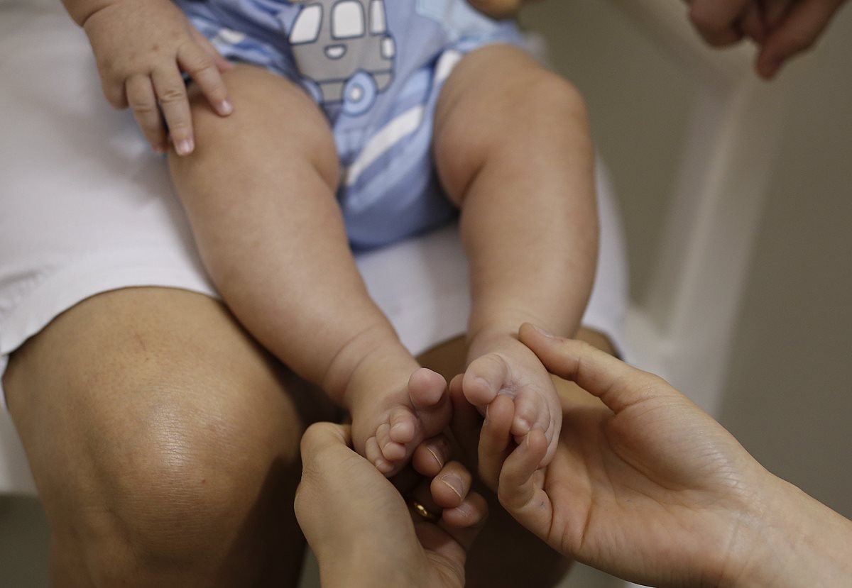 Se sospecha que la rápida expansión del virus, según la OMS, es la causa de un repentino incremento de casos de microcefalia congénita en recién nacidos. (Foto Prensa Libre: AP).