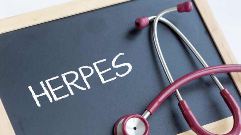 Muchos genes humanos previamente implicados en el alzhéimer se activan o suprimen en respuesta a la presencia de genes virales, como los del herpes. (Getty Images).