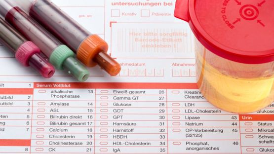 El pH de la sangre humana oscila en valores de entre 7,35 y 7,45. GETTY IMAGES