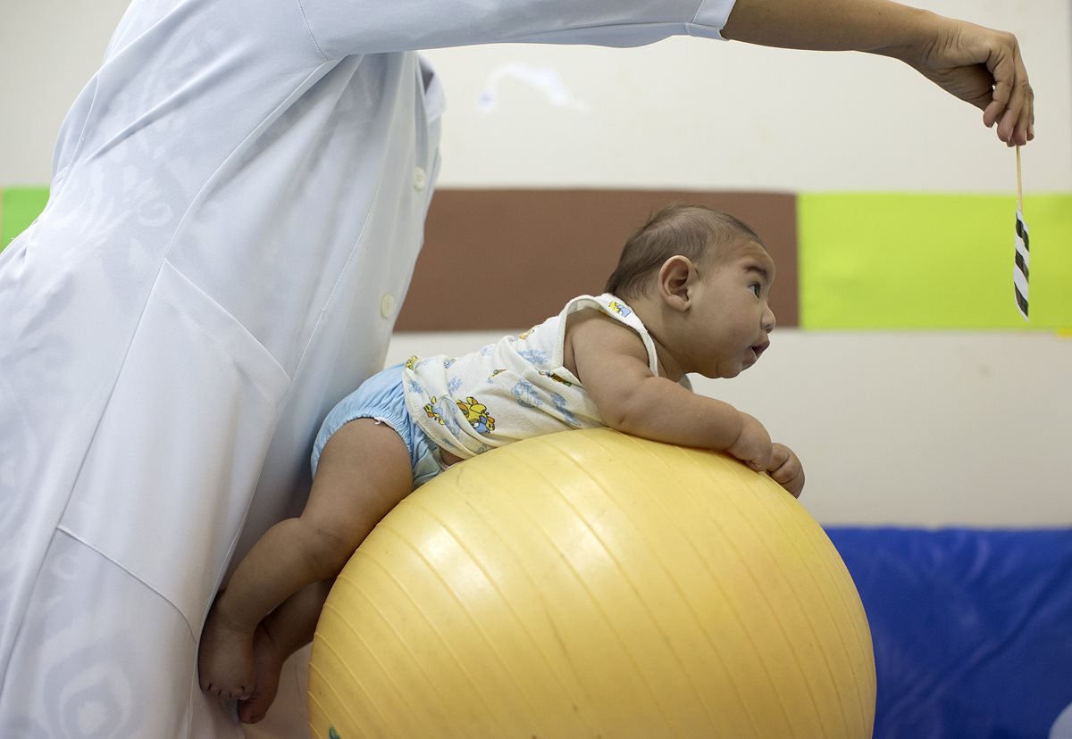 Científicos aún exploran la relación entre el virus del Zika y la microcefalia. (Foto Prensa Libre: AP).