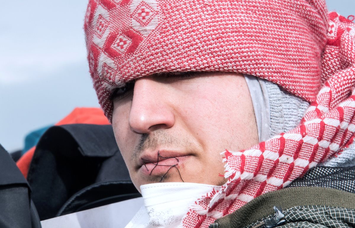 Un migrante muestra a periodistas su boca cosida en señal de protesta. (Foto Prensa Libre: AFP).