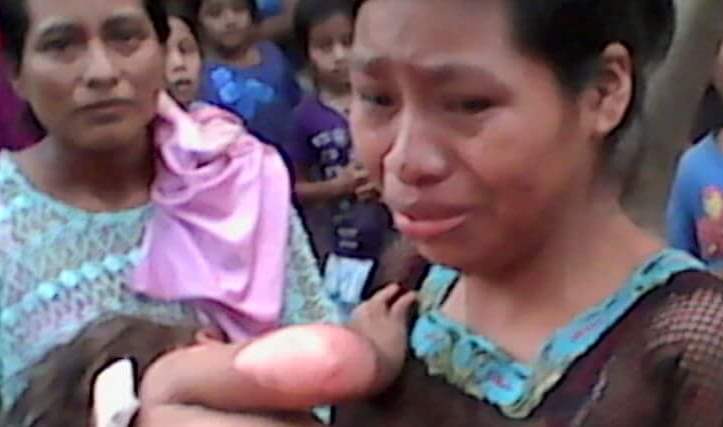 Niña quemada es trasladada a un centro asistencial en La Tinta, Alta Verapaz. (Foto Prensa Libre: Eduardo Sam Chun)